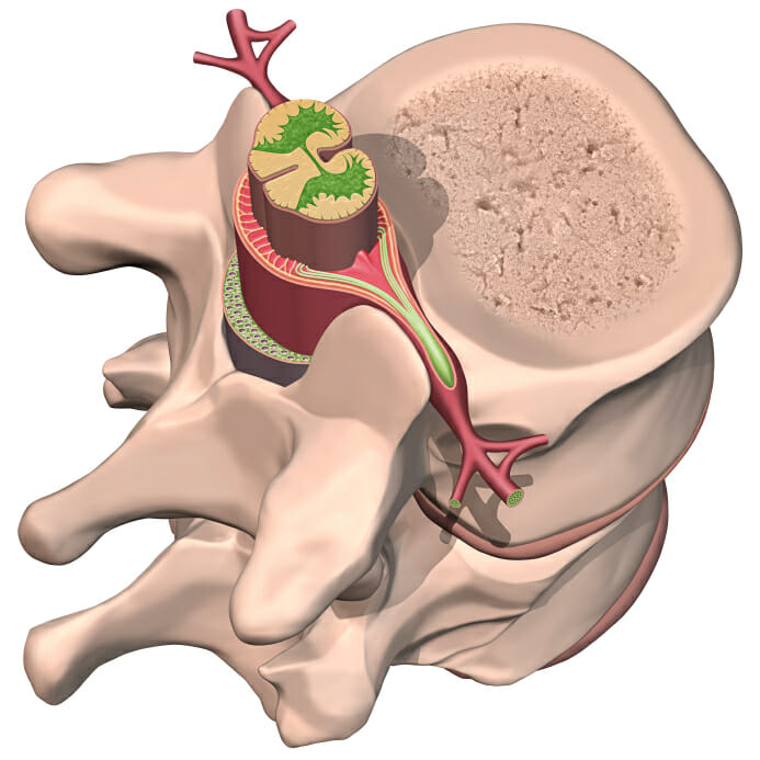 neck pain in New York City