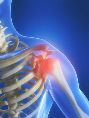new york physical therapy humerus fracture