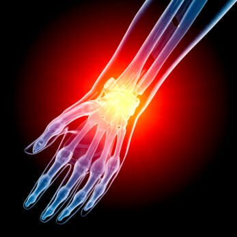 broken wrist in new york city