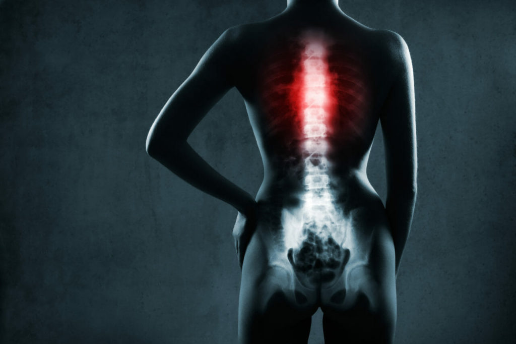 back pain in new york city T4 syndrome